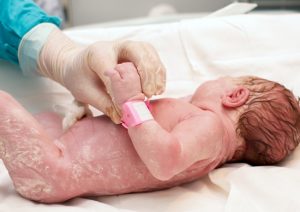 6 beneficii miraculoase ale vernixului