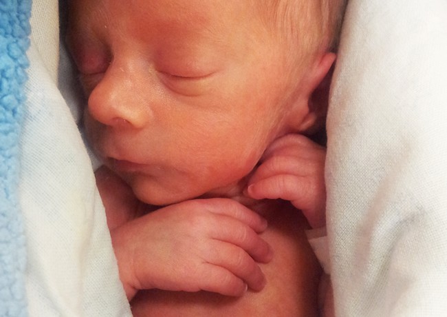 Simptomele Si Cauzele Unei Nasteri Premature Bebebliss Ro