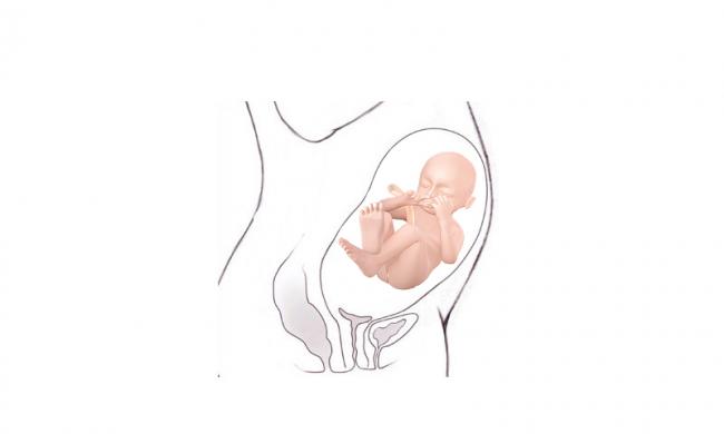 Saptamana 28 De Sarcina Bebebliss Ro