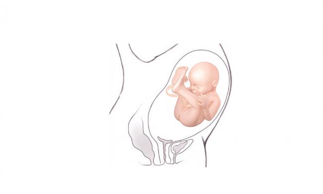 Saptamana 33 De Sarcina Bebebliss Ro Saptamana 33 De Sarcina Bebebliss Ro