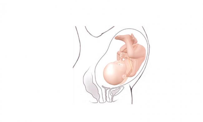 Saptamana 35 De Sarcina Bebebliss Ro